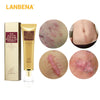 LANBENA Acne Scar Removal Cream Skin Repair Face Cream Acne Spots Acne Treatment Blackhead Whitening Cream